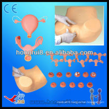 HOT SALES Senior medical gynecological simulator